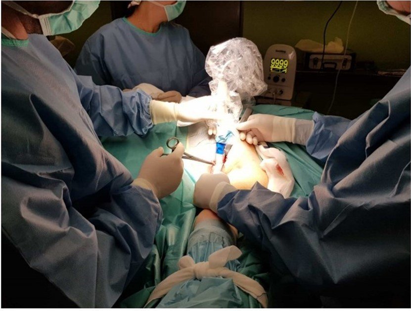 El Hospital de Riotinto acoge una técnica pionera en el mundo