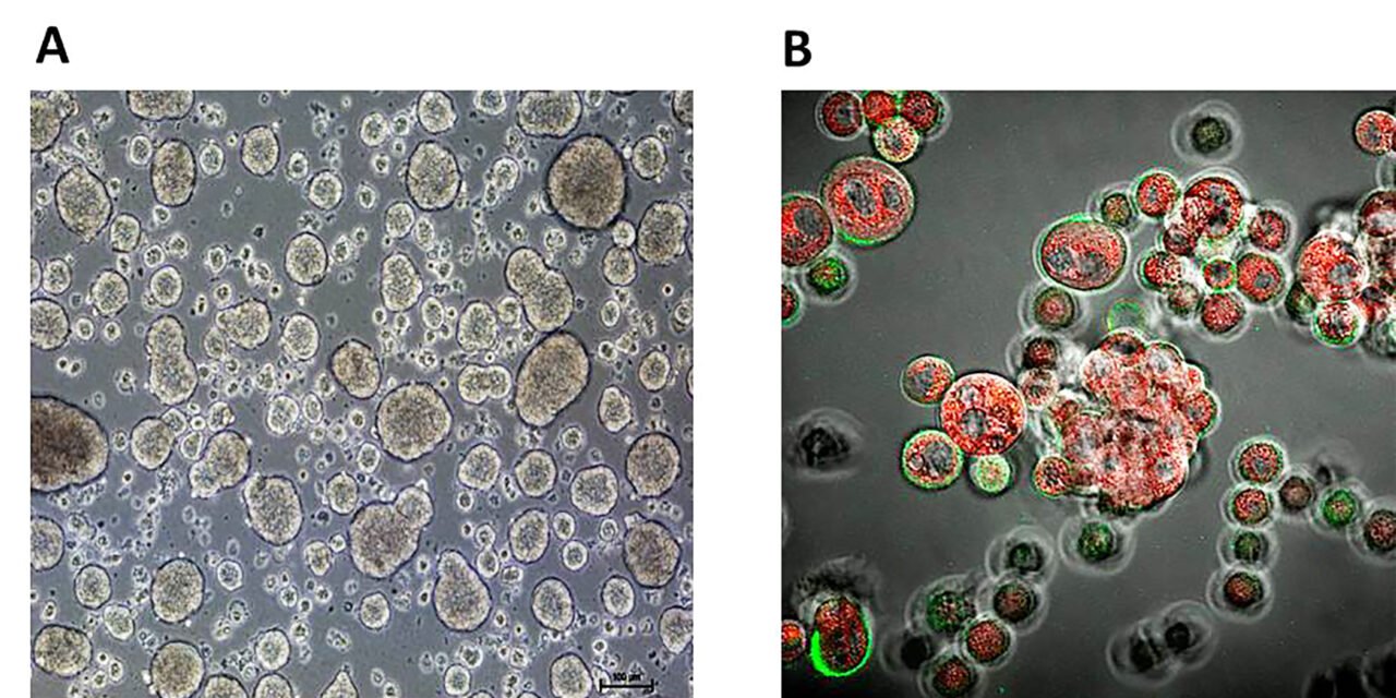 Diseñan nanocápsulas de aceite de oliva inteligentes eficaces frente a células madre cancerígenas