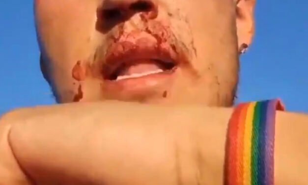 Agreden a un joven en Sanlúcar del Guadiana al grito de “maricón de mierda”