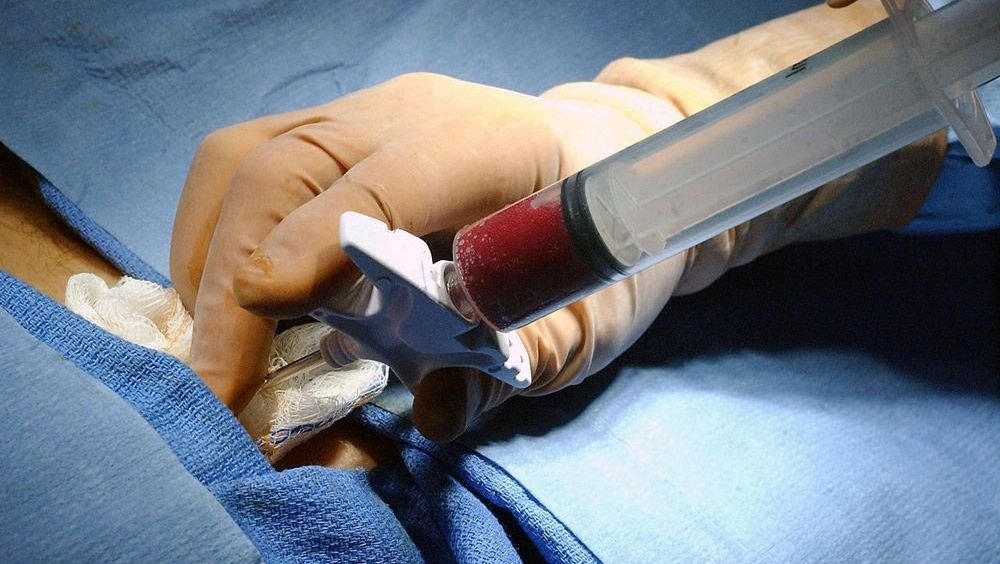 El Juan Ramón lleva a cabo más de 200 trasplantes de médula ósea en 15 años