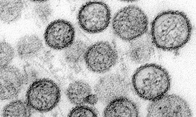 La UHU plantea participar en la crisis contra el hantavirus utilizando la IA
