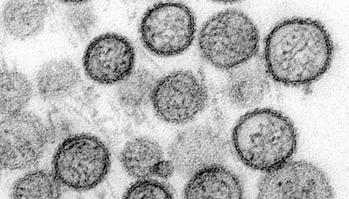 La UHU plantea participar en la crisis contra el hantavirus utilizando la IA