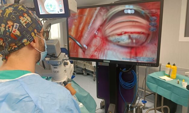 El Hospital de Riotinto perfecciona la cirugía de glaucoma